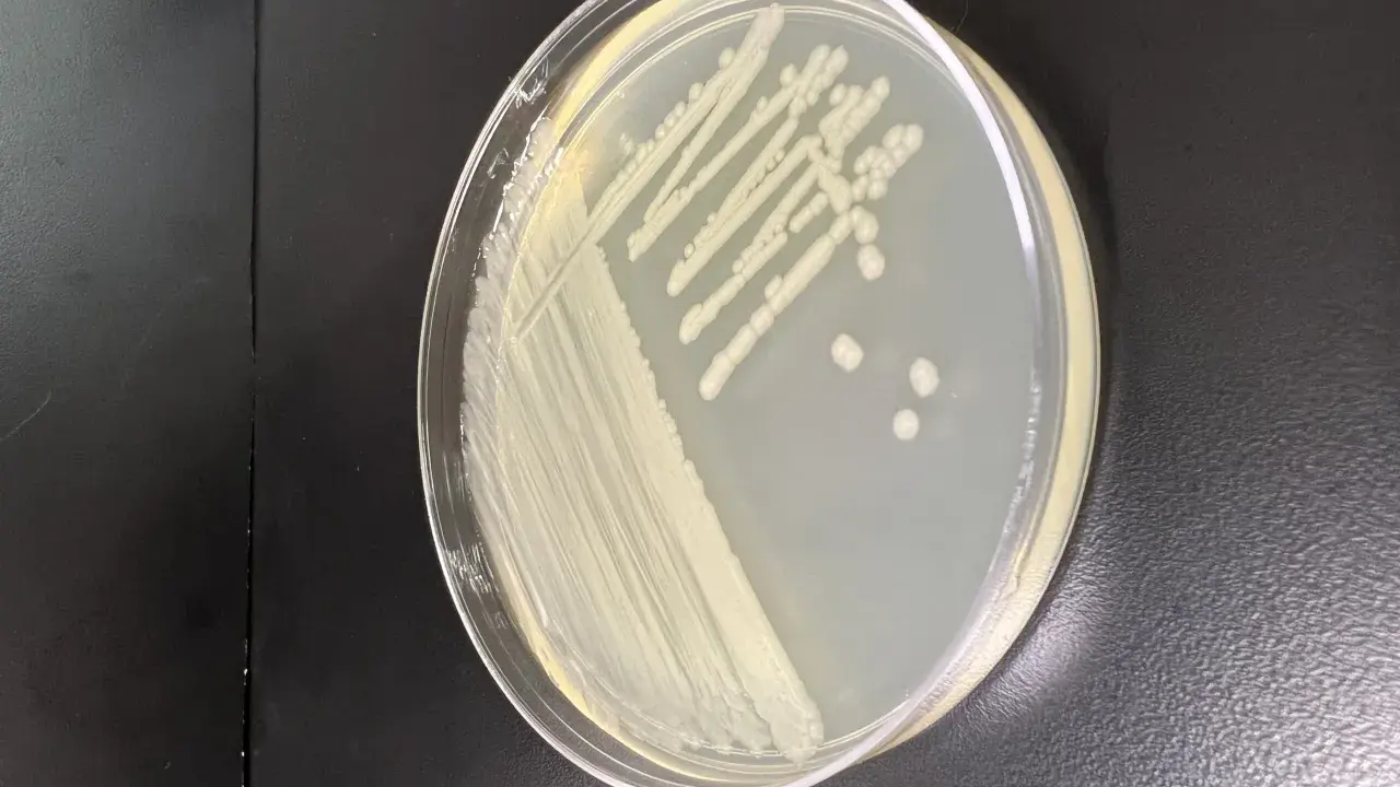 Colonia di batteri su piastra di Petri, forse Pseudomonas putida, con crescita a strisce e colonie isolate.