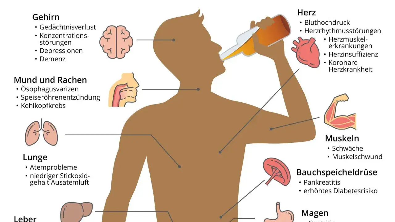 Illustration zeigt Symptome von Alkoholsucht: Gehirn, Herz, Lunge, Leber, Magen, Bauchspeicheldrüse, Muskeln, Mund & Rachen. Die 10 Stufen des Alkoholismus sind hier nicht dargestellt.