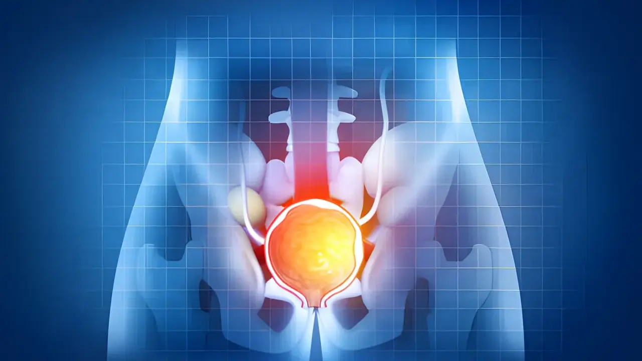 Anatomical illustration of the male pelvic region, highlighting the bladder and prostate. Czy przerost prostaty może się cofnąć?