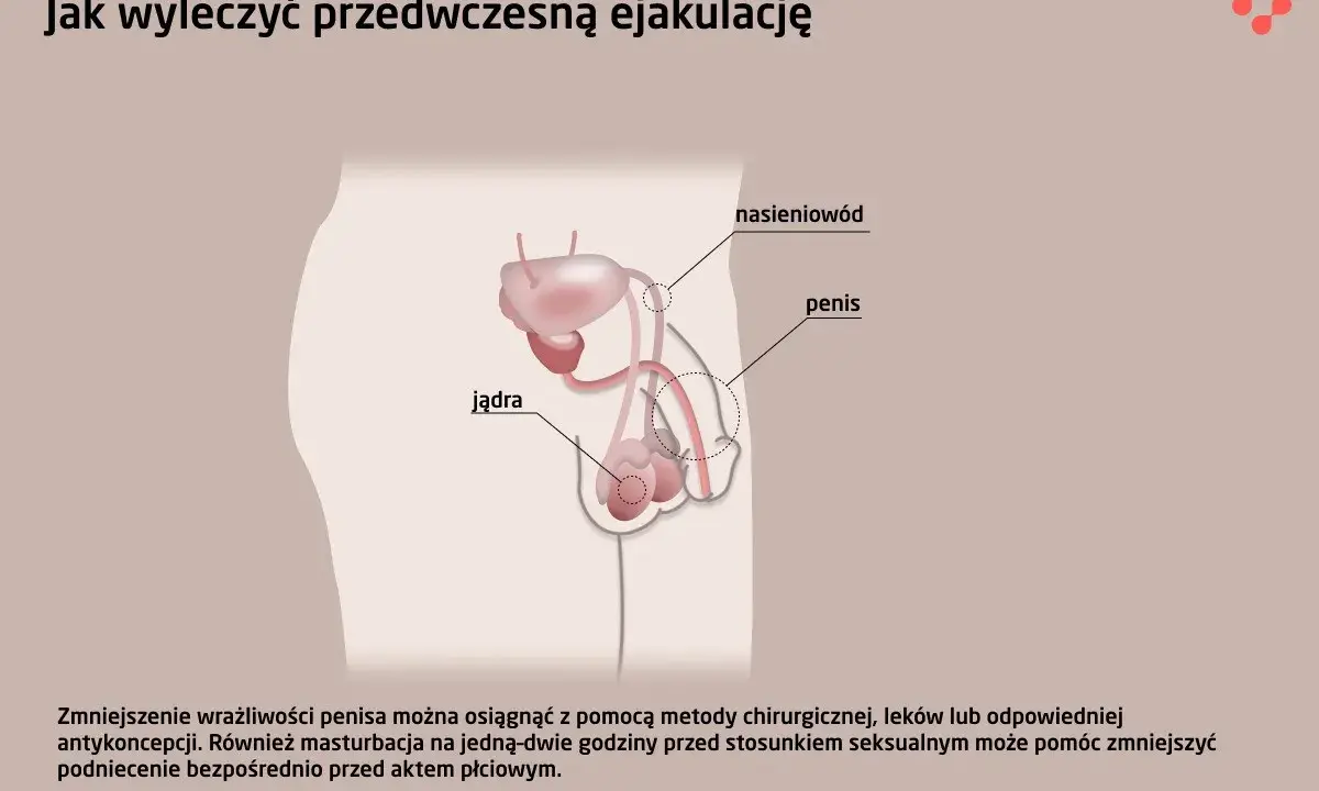 Ilustracja układu rozrodczego męskiego, omawiająca metody leczenia problemów z wytryskiem, w tym zmniejszenie wrażliwości penisa.