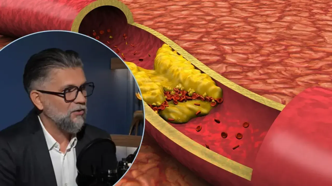 Mężczyzna w okularach opowiada o tym, jak wyleczył miażdżycę, podczas gdy na ekranie widać przekrój tętnicy z cholesterolem i czerwonymi krwinkami.