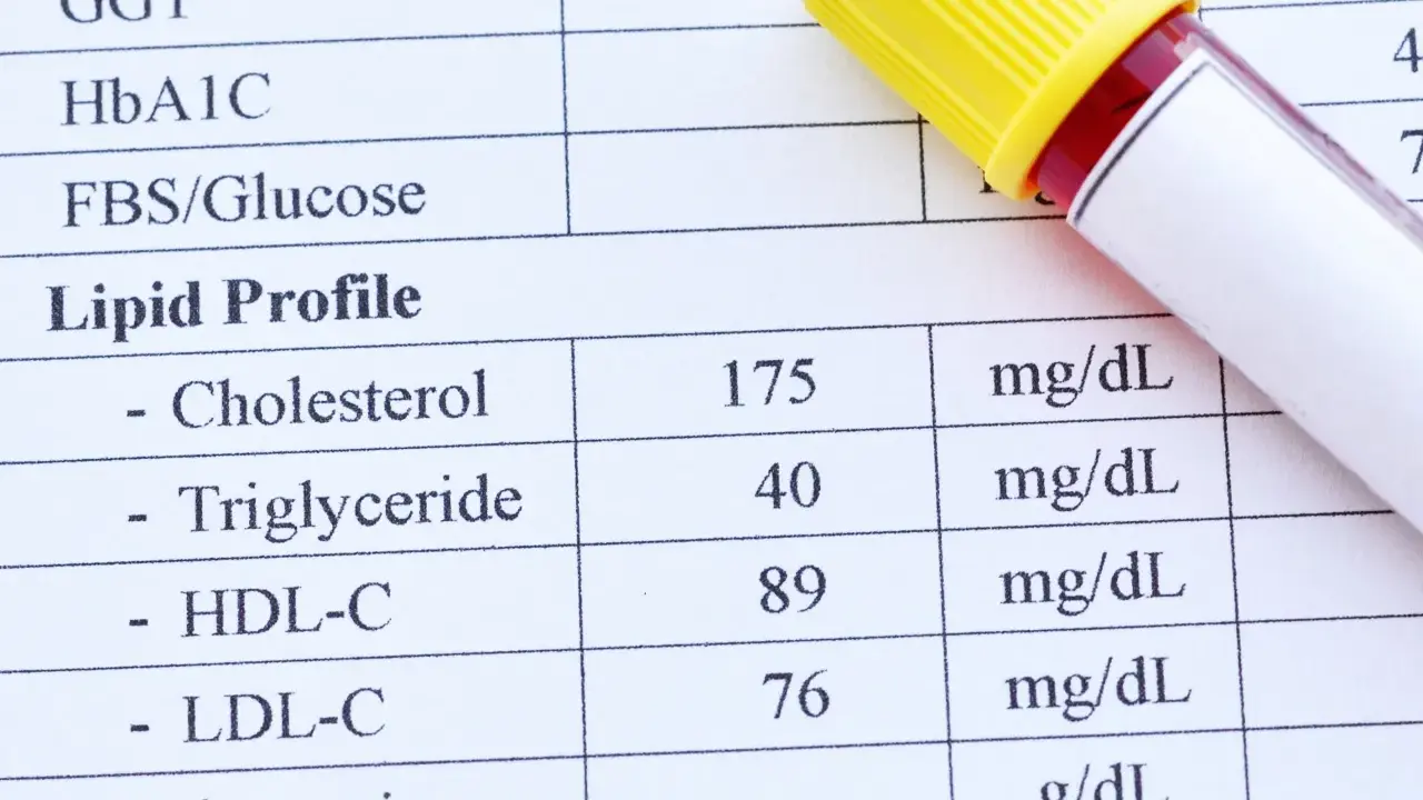 Fragment analizy lipidowej z wynikami cholesterolu, trójglicerydów, HDL-C i LDL-C oraz probówką krwi.