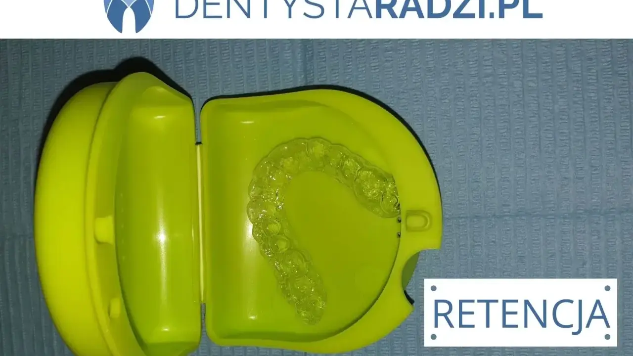 Przezroczyste nakładki na zęby po aparacie ortodontycznym w zielonym etui. Retencja dla pięknego uśmiechu.