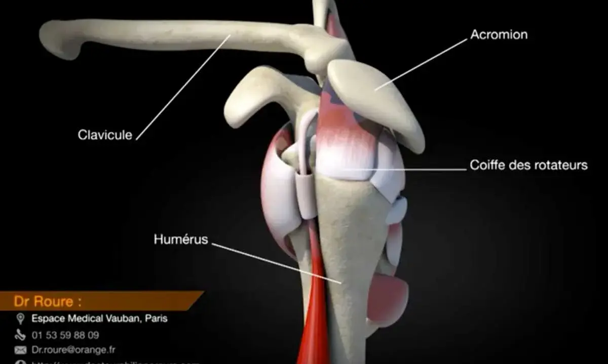 Anatomie de l'épaule montrant la clavicule, l'humérus et la coiffe des rotateurs. Une rupture de la coiffe des rotateurs peut être une maladie professionnelle.