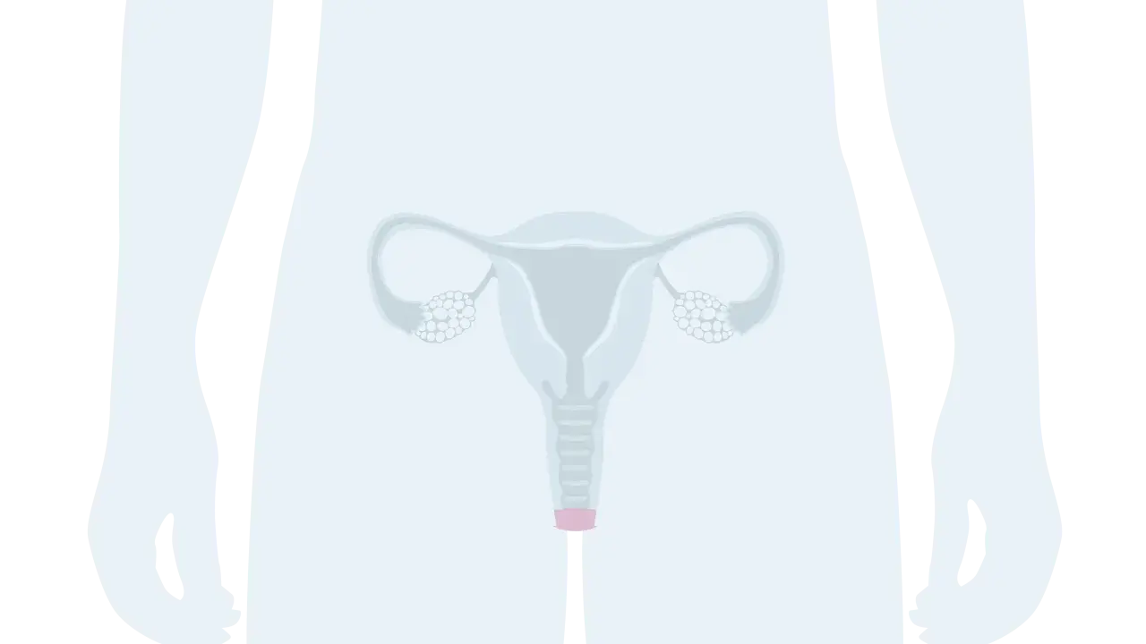 Illustration av kvinnliga könsorgan. En illustration som visar livmoder, äggledare och äggstockar. Ibland kan man uppleva luft ur underlivet.