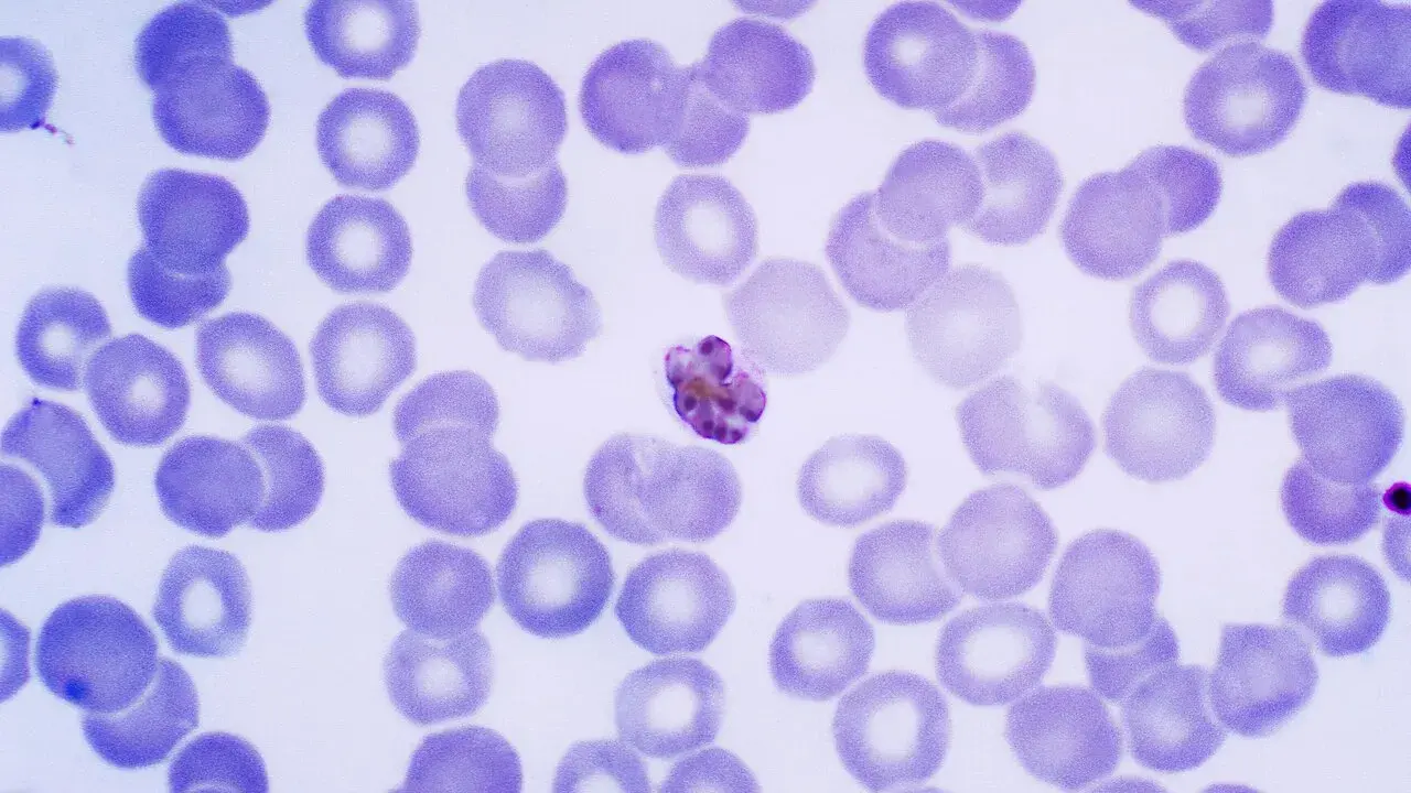 Microscopic view of red blood cells with a malaria parasite.
