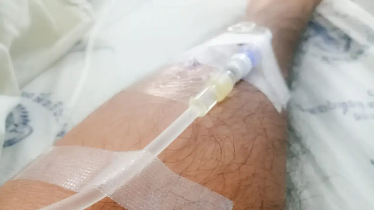 Ręka z założonym cewnikiem dializacyjnym, widoczna jest taśma medyczna i fragment pościeli szpitalnej. Pielęgnacja cewnika dializacyjnego jest kluczowa.