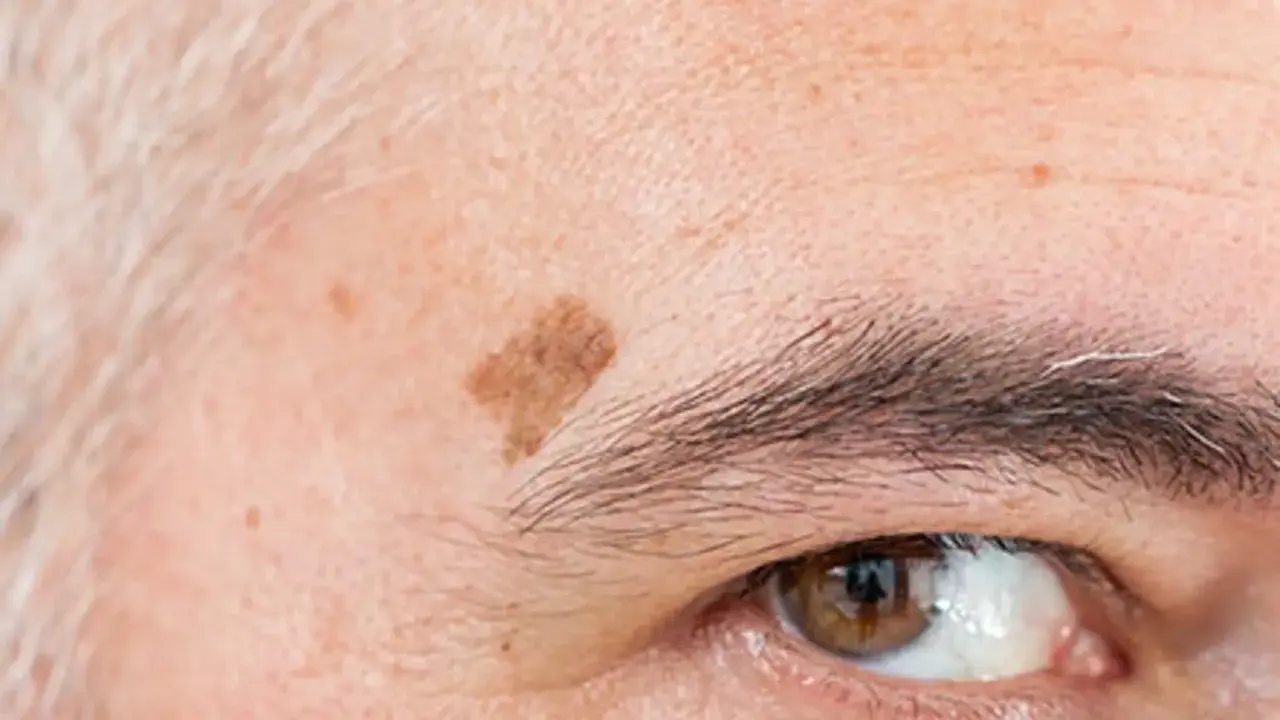 Gros plan sur le coin de l'œil d'une personne âgée, montrant des taches de vieillesse sur la peau et des sourcils poivre et sel.