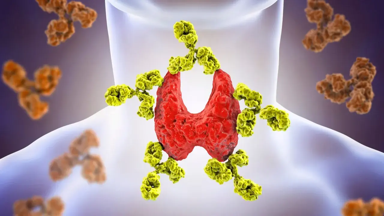 Tarczyca atakowana przez żółte przeciwciała, ilustracja chorób autoimmunologicznych. W tle brązowe przeciwciała.