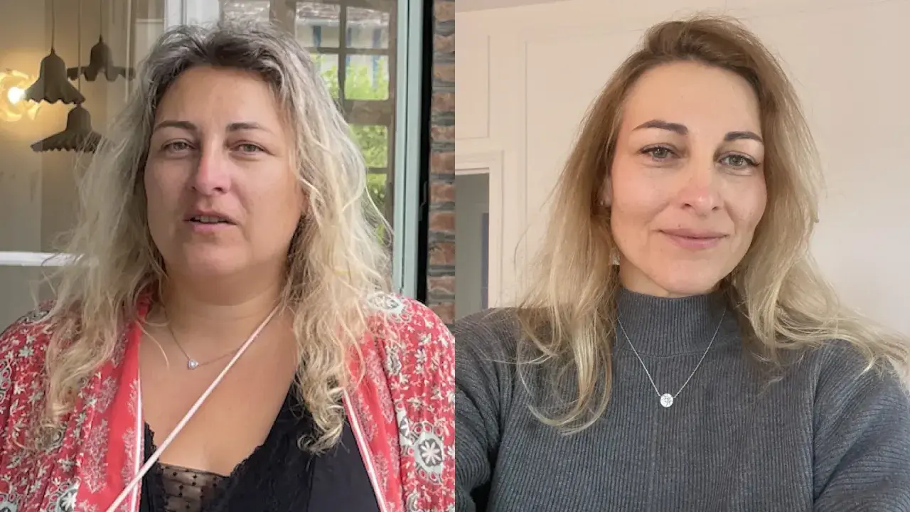 Avant/après : le visage s'affine visiblement après une perte de poids. La question "à partir de combien de kilos perd on du visage" trouve ici une réponse visuelle.