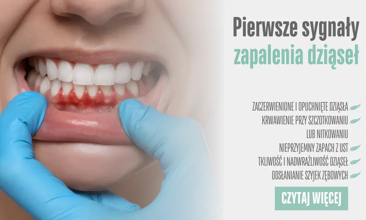 Zapalenie dziąseł: 7 objawów, których nie wolno ignorować!