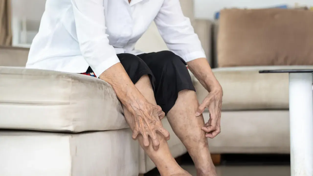 Gambe anziani con pelle secca e macchie, che indicano il passare del tempo e la necessità di cure.
