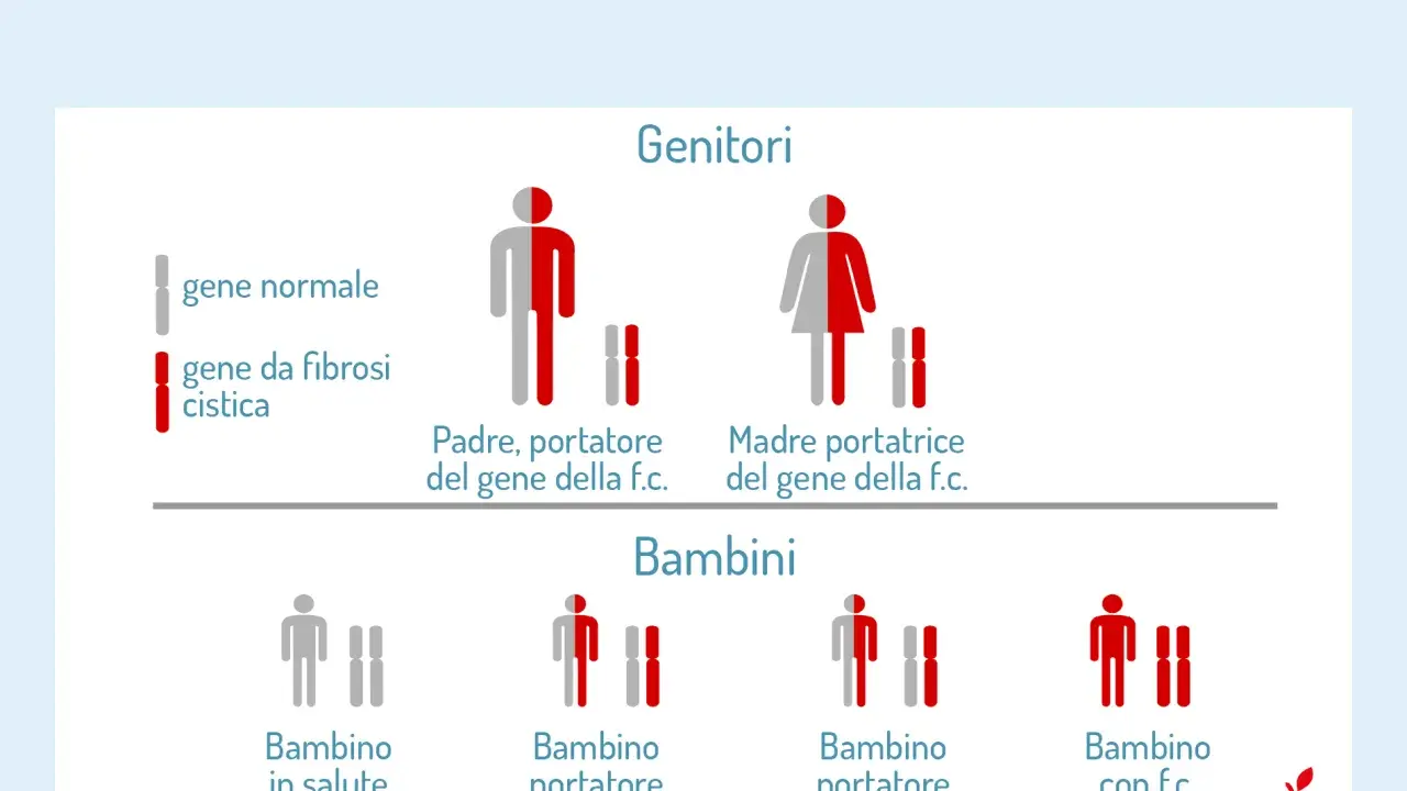 Schema sull'eredità della fibrosi cistica. Mostra genitori portatori sani e i possibili esiti per i bambini, inclusa la fibrosi cistica atipica.
