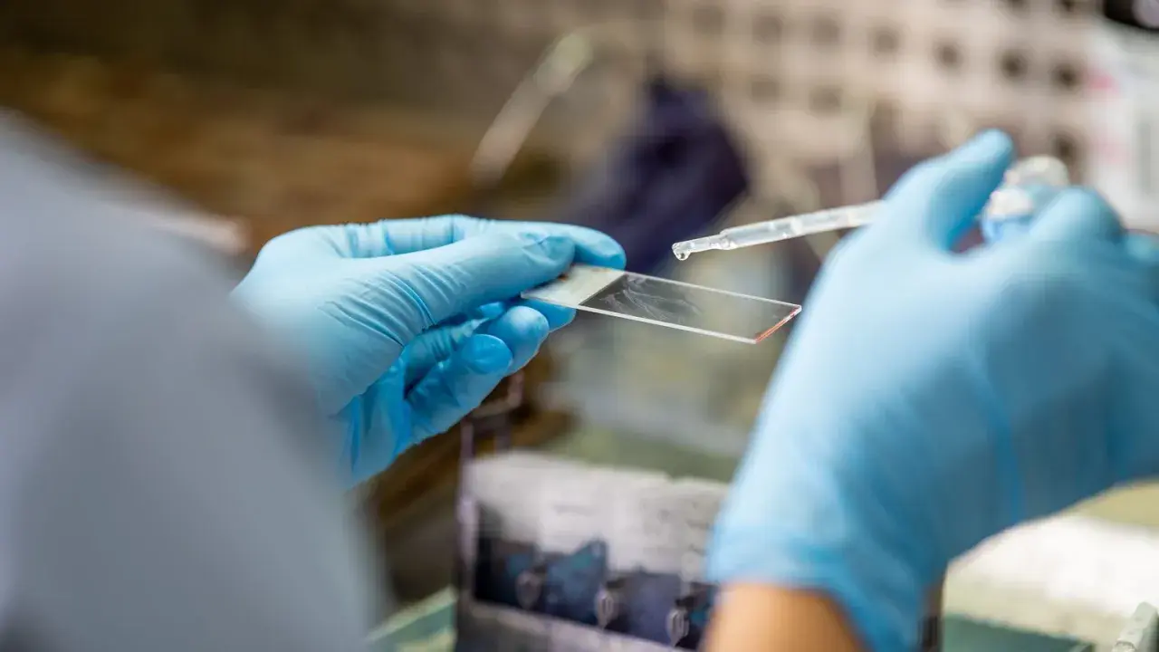 Ręce w niebieskich rękawiczkach trzymają szkiełko mikroskopowe, na które pipetą dodawana jest kropla płynu.