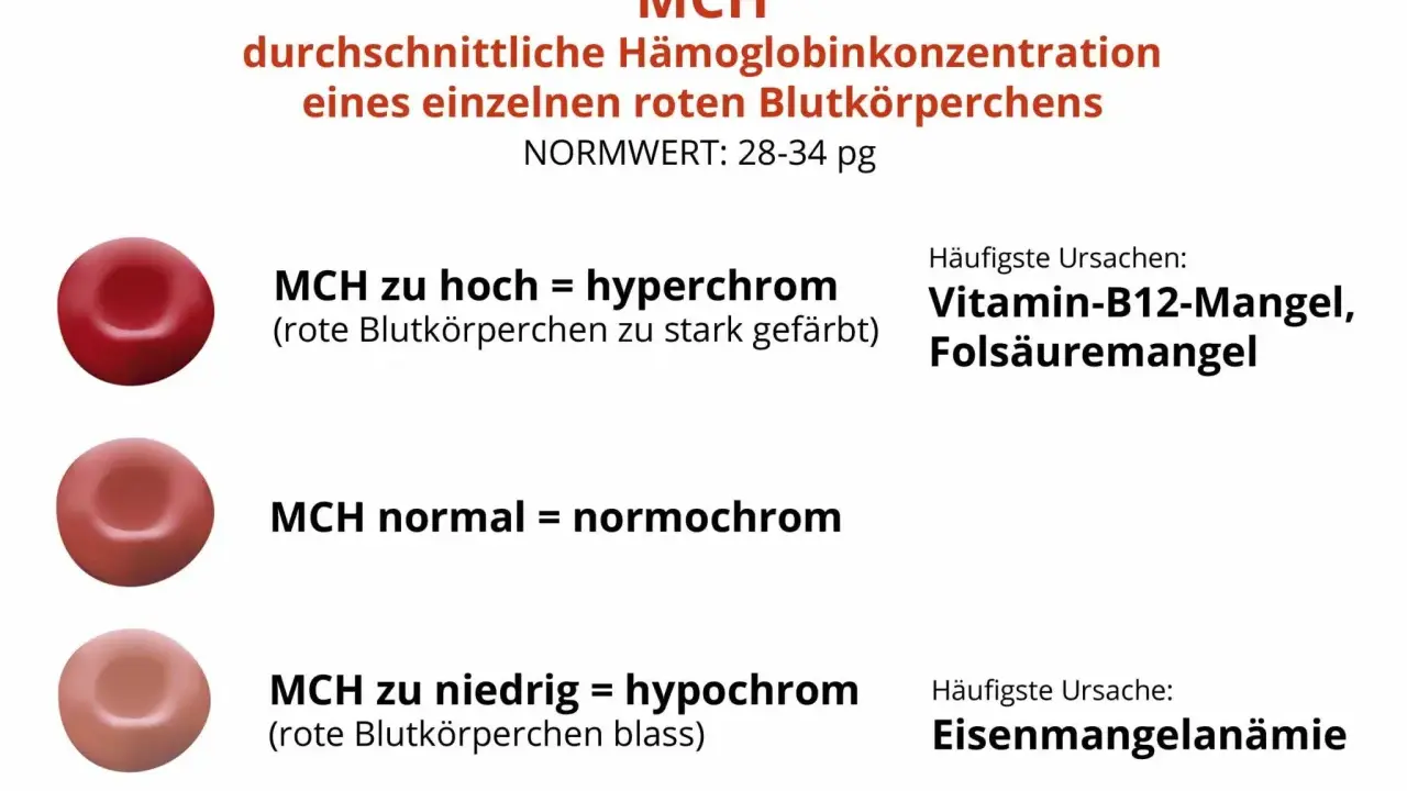 MCH-Wert: rote Blutkörperchen können hyperchrom (zu stark gefärbt), normochrom oder hypochrom (blass) sein. Ursachen für MCH-Abweichungen sind u.a. Vitaminmangel oder Eisenmangelanämie.