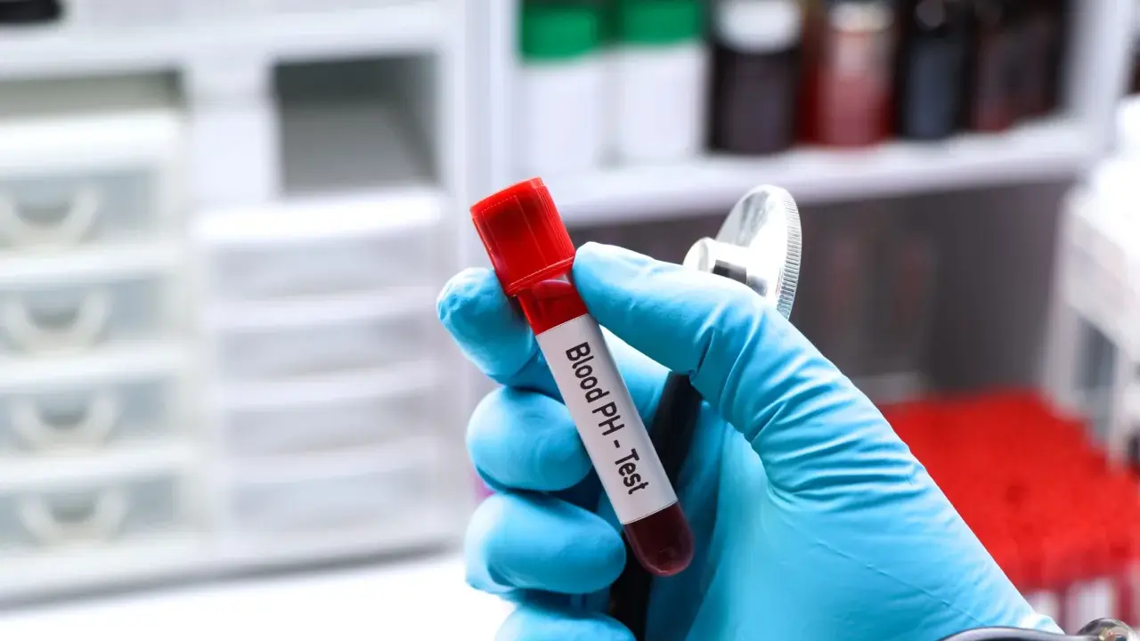 Ręka w niebieskiej rękawiczce trzyma probówkę z krwią do badania pH. Gazometria jest kluczowa w diagnostyce niewydolności nerek.