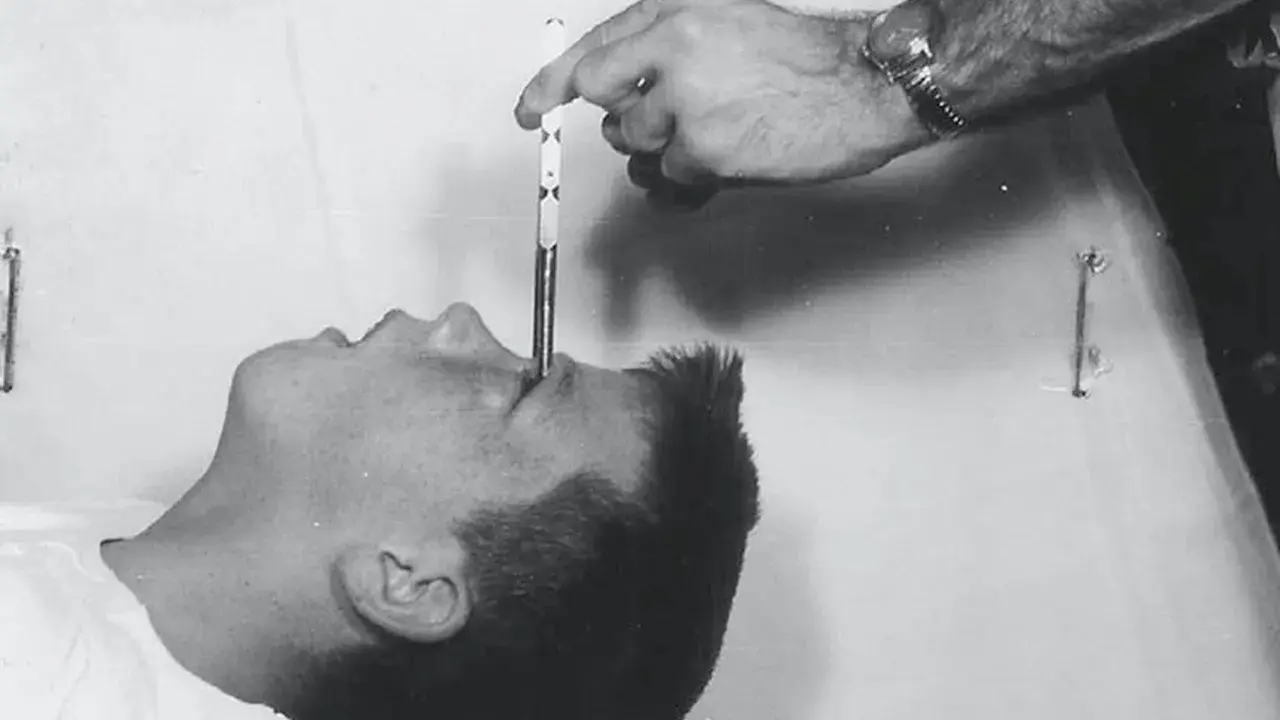 En hand för in en lobotomikniv i en patients öga. En mörk period i psykiatrins historia, även i Sverige.