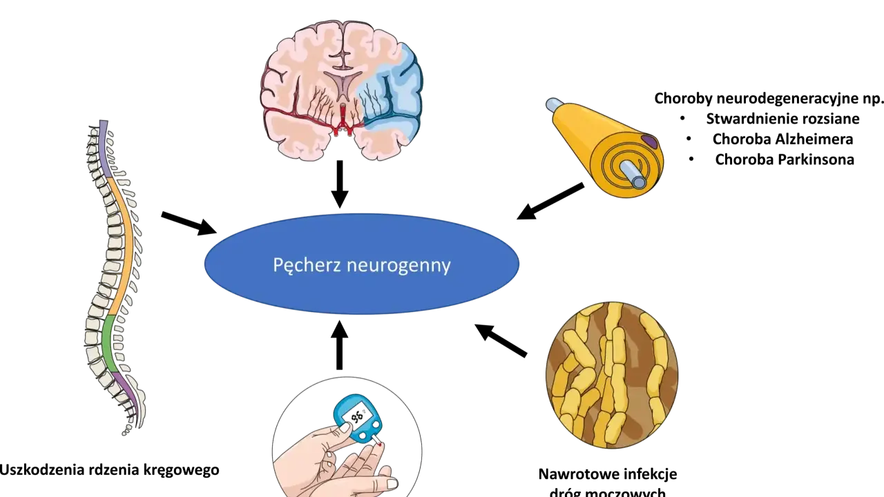 Ilustracja przedstawia mózg, rdzeń kręgowy, neuron i glukometr, które mogą wpływać na pęcherz neurogenny. Ćwiczenia na pęcherz neurogenny są kluczowe.