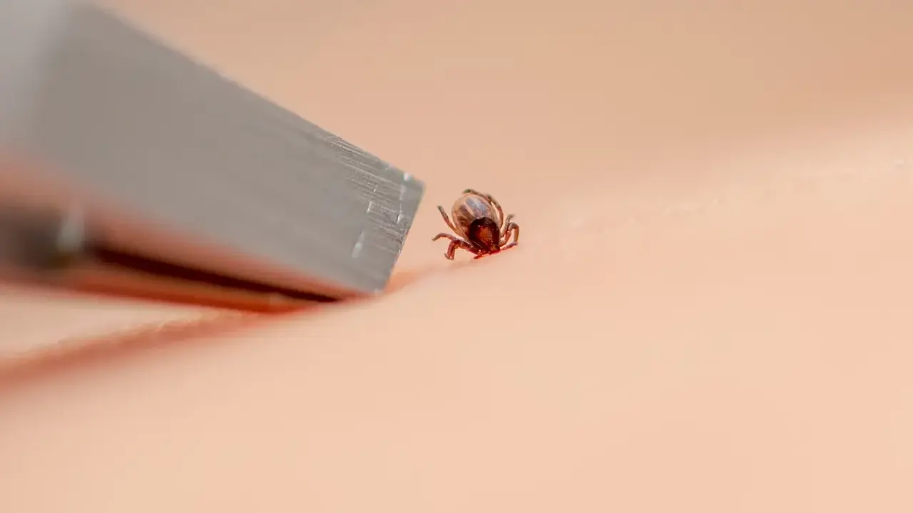 Kleszcz? Usuń go bezpiecznie! Instrukcja krok po kroku i mity
