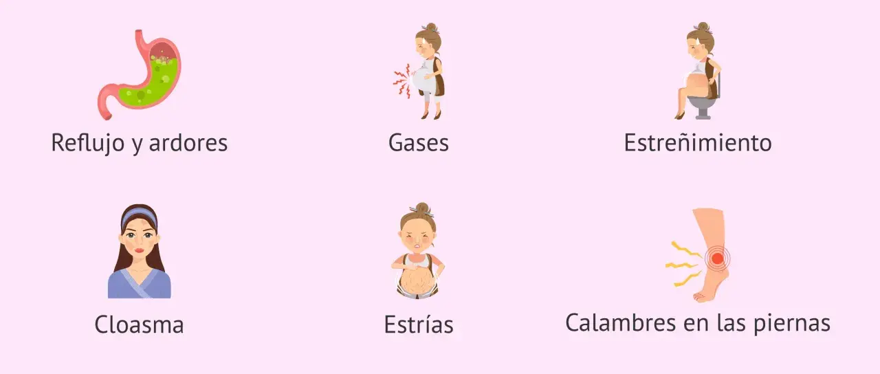 Ilustraciones de síntomas comunes del embarazo: reflujo, gases, estreñimiento, cloasma, estrías y calambres en las piernas. Semana 25.