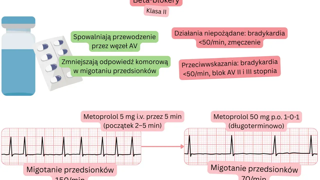 Beta-blokery spowalniają przewodzenie, zmniejszając częstość komór w migotaniu przedsionków. Metoprolol podany i.v. lub p.o. poprawia rytm serca.