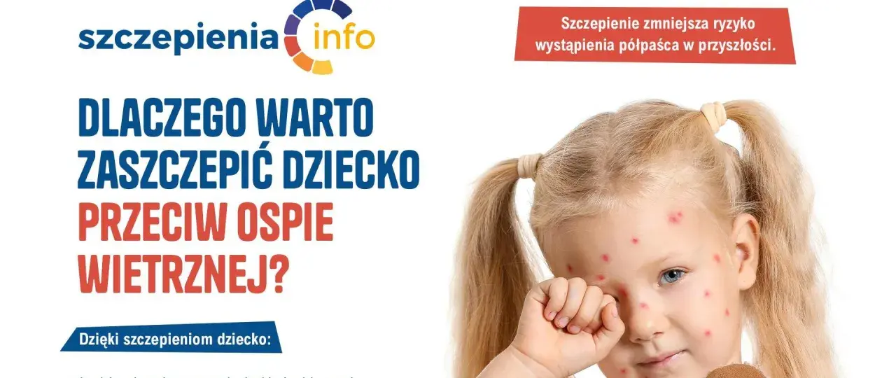 Dziewczynka z ospą wietrzną. Kampania informacyjna o szczepionce na ospę, podkreślająca jej znaczenie dla zdrowia dziecka.