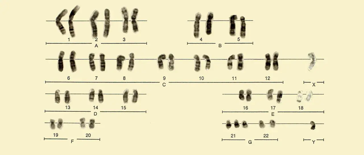 Cariotipo masculino con cromosomas ordenados por tamaño y forma, incluyendo los cromosomas sexuales X e Y.