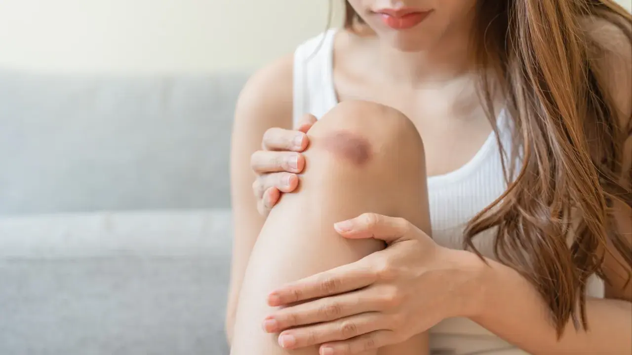 Une femme examine une ecchymose sur son genou, cherchant un remède de grand-mère pour effacer les cicatrices.