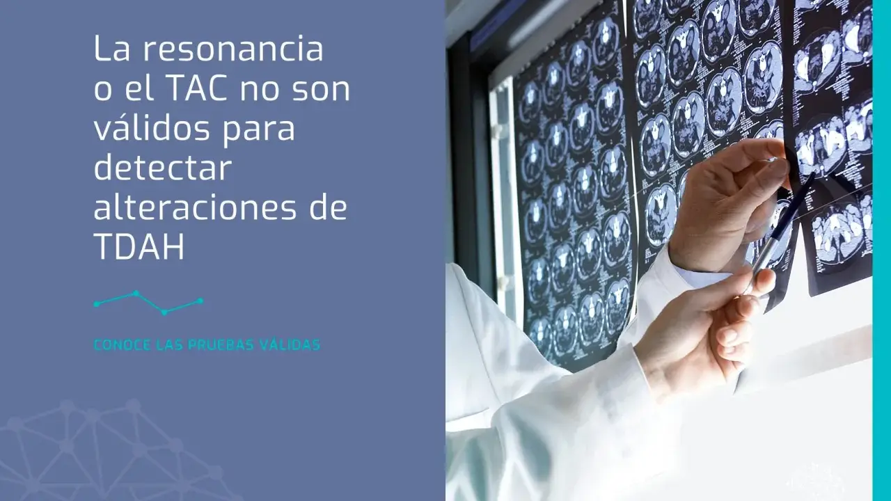 Médico revisa TACs cerebrales. La resonancia o TAC no detectan TDAH. Descubre qué puede estudiar un adolescente con TDAH.