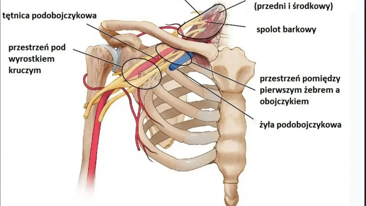 Anatomia górnego otworu klatki piersiowej: tętnica i żyła podobojczykowa, mięśnie pochyłe, splot barkowy.