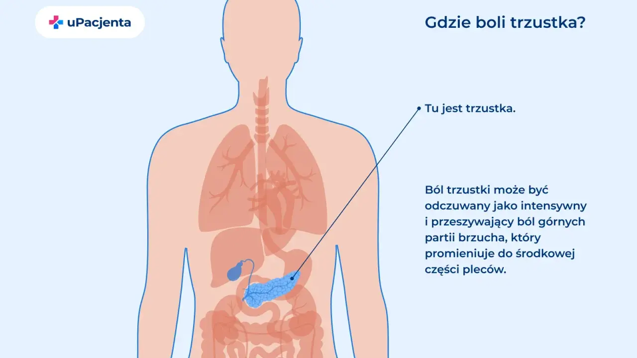 Anatomia człowieka z zaznaczoną trzustką. Ból trzustki może być odczuwany jako intensywny ból brzucha promieniujący do pleców.
