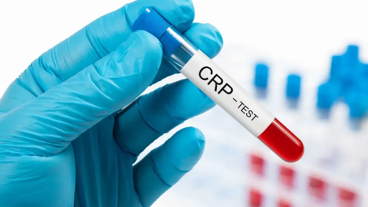 Ręka w niebieskiej rękawiczce trzyma probówkę z napisem "CRP - TEST". Badanie CRP pomaga ocenić stan zapalny w organizmie.