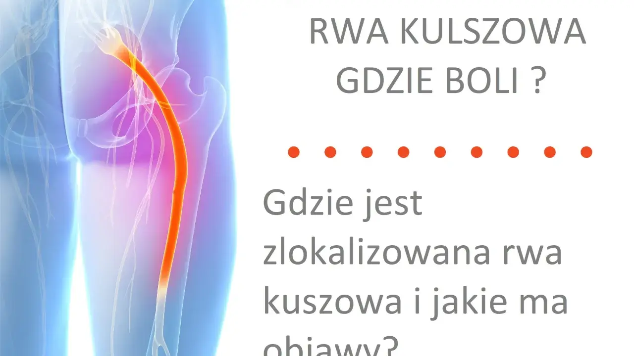Ból kręgosłupa lędźwiowego promieniujący do nóg - rwa kulszowa. Ilustracja pokazuje przebieg nerwu kulszowego.