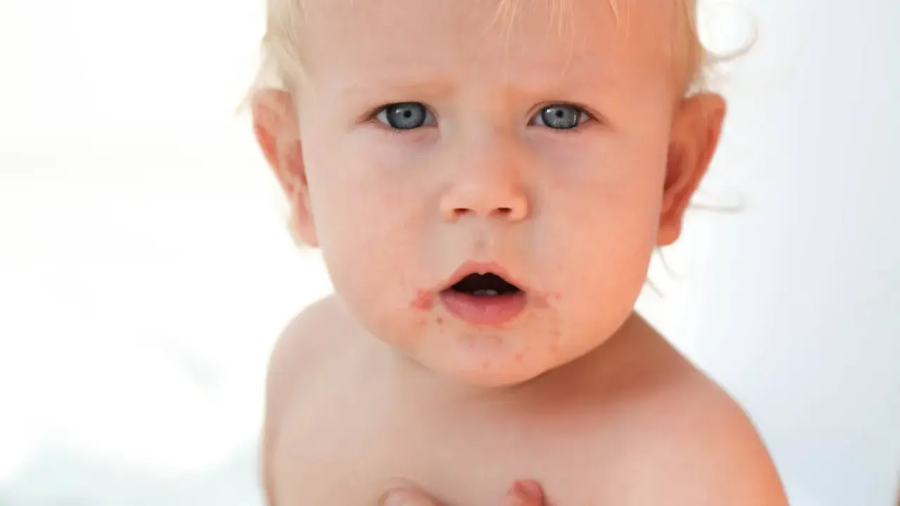 Visage d'un bébé aux yeux bleus, présentant des rougeurs autour de la bouche, possiblement un eczéma bouche bébé.