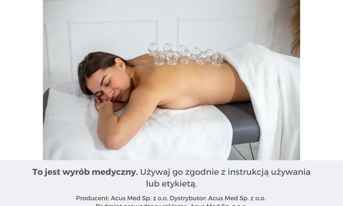 Kobieta leży na plecach, na jej kręgosłupie umieszczono szklane bańki na plecy.