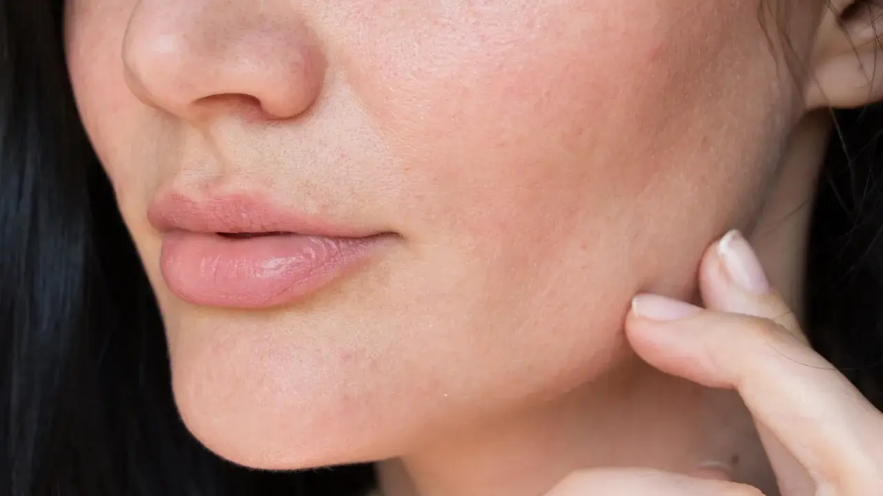 Dita che accarezzano il viso, mostrando come idratare la pelle del viso molto secca per un aspetto radioso e morbido.