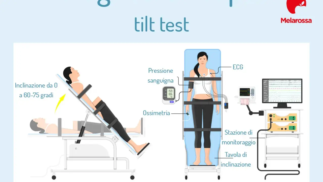 Test tilt per la diagnosi di sincope. Monitoraggio ECG, pressione e ossimetria. Simula la sensazione di svenire ma non svengo, ansia.