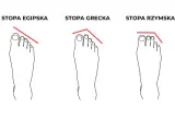 Ilustracja przedstawia trzy rodzaje stóp: egipską, grecką i rzymską, z zaznaczonymi liniami pokazującymi kształt palców.