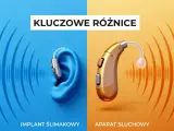 Porównanie implantów ślimakowych i aparatów słuchowych. Dwa rodzaje aparatów słuchowych, jeden w uchu, drugi na zewnątrz.