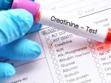 Rękawiczka w niebieskiej rękawiczce trzyma probówkę z napisem "Creatinine - Test". Obok znajduje się formularz z zaznaczoną opcją "Creatinine", sugerującą badanie kreatyniny w celu sprawdzenia jej normy.