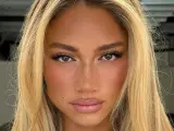 Primer plano de una mujer con cabello rubio y ojos separados, pecas sutiles y labios rosados.