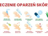 Ilustracja pokazuje leczenie oparzeń skóry: chłodna woda, maść z antybiotykiem, zimny kompres, tabletki przeciwbólowe, sok z aloesu. Unikaj masła, jajek, pasty do zębów, lodu.