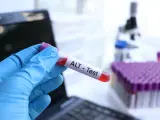 Ręka w niebieskiej rękawiczce trzyma probówkę z krwią oznaczoną "ALT - Test". W tle mikroskop i stojak z próbkami. To badanie ALT.