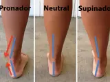 Comparación de pisadas: pronador, neutral y supinador. El desgaste de zapatillas varía según el tipo de pisada.