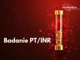 Badanie PT/INR, czyli czas protrombinowy, to kluczowy test oceniający krzepliwość krwi. W probówce widoczne są złote elementy, symbolizujące próbkę.