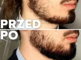 Gęsty zarost: Jak szybko rośnie i co realnie przyspieszy brodę?