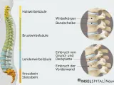Illustration der Wirbelsäule mit Darstellung eines Wirbelbruchs. Mögliche wirbelbruch symptome werden durch die gezeigten Frakturen verdeutlicht.