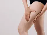 Une femme touche sa cuisse, montrant les capitons de la cellulite.