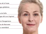 Rostro de mujer con líneas de expresión marcadas, mostrando arrugas estáticas en frente, ojos y alrededor de la boca.