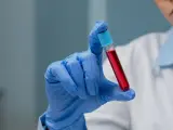 Ręka w niebieskiej rękawiczce trzyma probówkę z czerwoną cieczą. To może być próbka do badań, np. PDW co to jest, czyli wskaźnik anizocytozy płytek krwi.